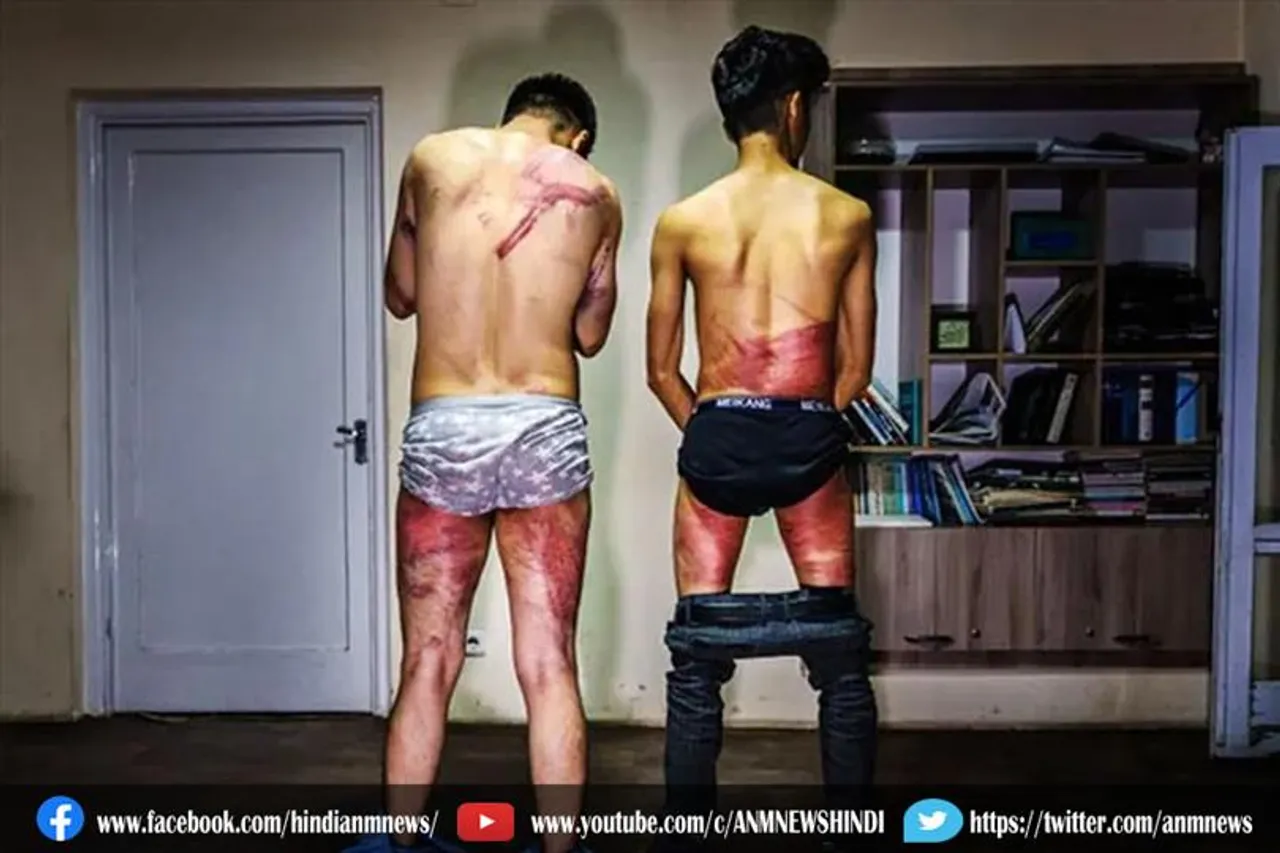 खौफनाक सच्चाई: तालिबान ने पत्रकारों को मार-मारकर उतारी खाल