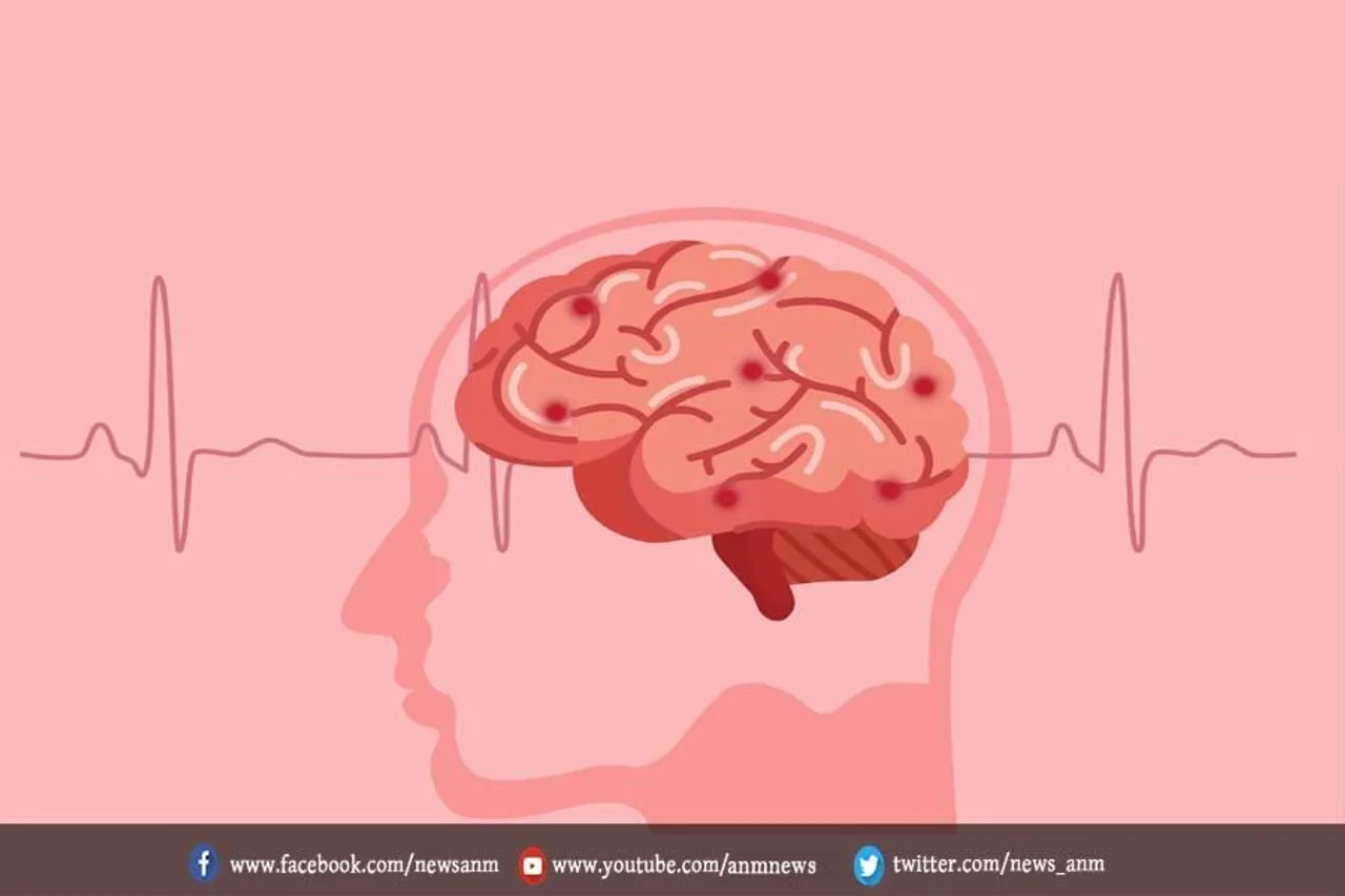 जानिए ब्रेन स्‍ट्रोक की वजह