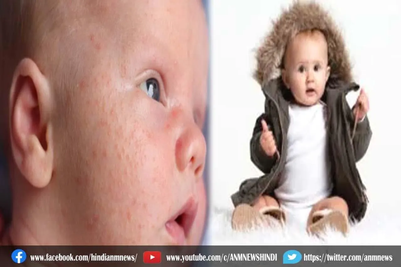 जानिए, फर वाले कपड़े से बच्चों को क्या क्या नुकसान पहुंचता है