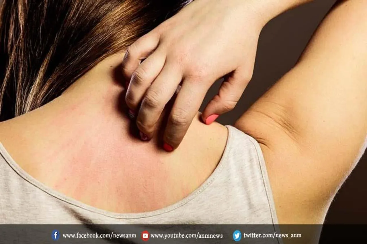 शरीर पर खुजली होने पर तुरंत करें ये घरेलू उपाय