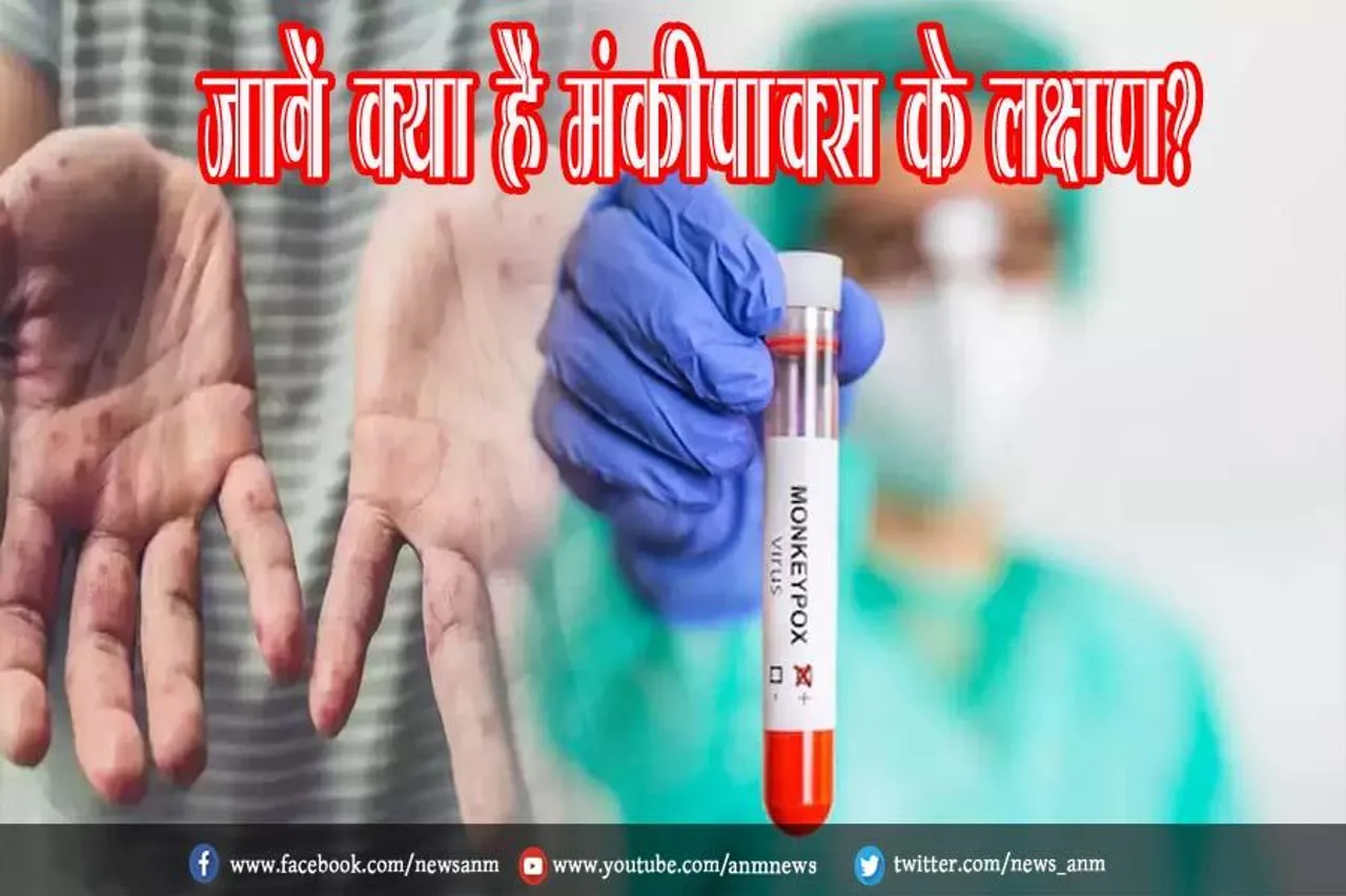 जानें क्या हैं मंकीपॉक्स के लक्षण?