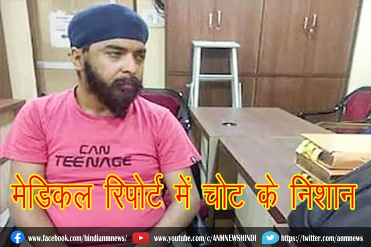 तेजिंदर बग्गा की मेडिकल रिपोर्ट में चोट के निशान