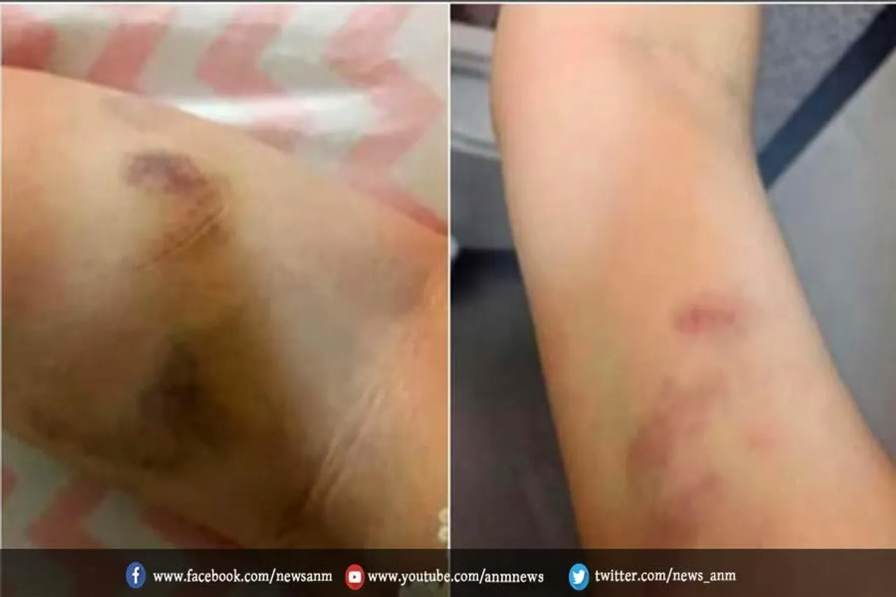 इस एक्टर ने पत्नी संग की मारपीट