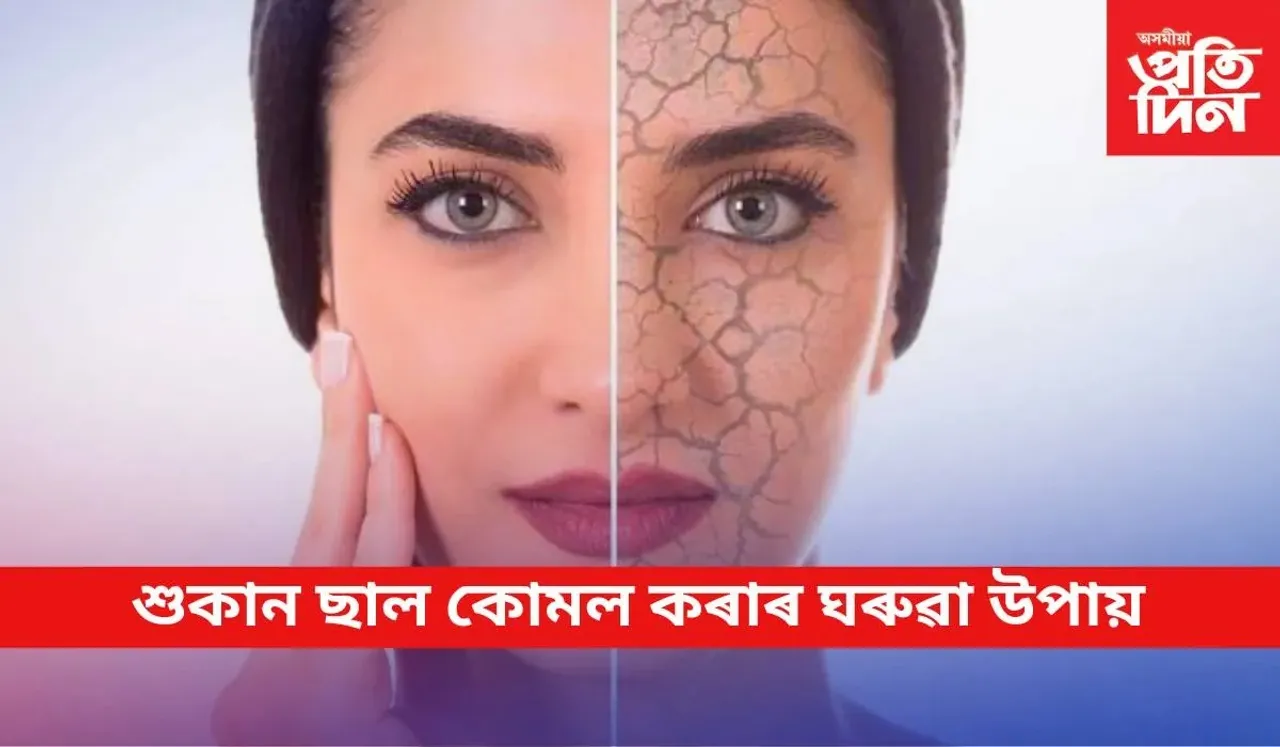 winter skincare