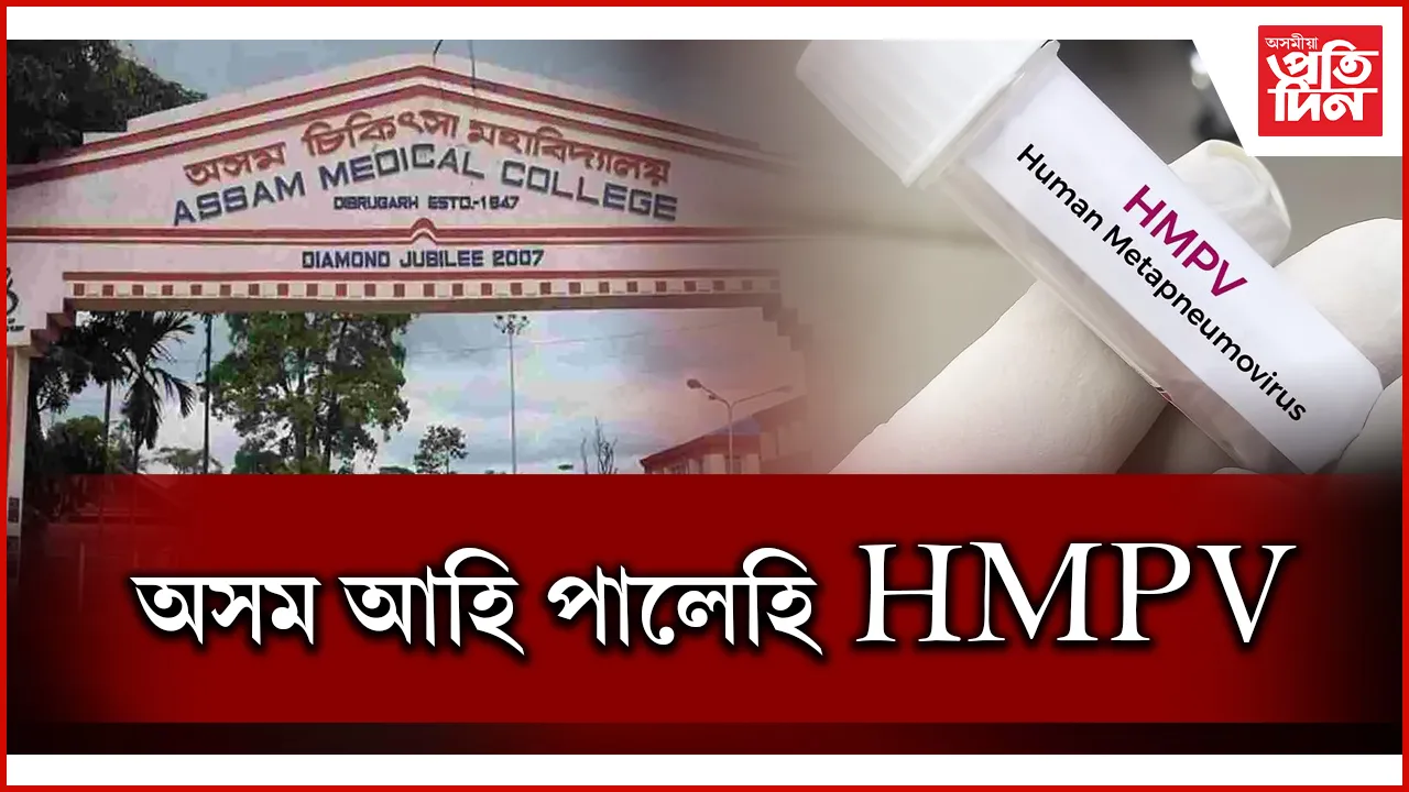 অসম মেডিকেল কলেজত চিকিৎসাধীন ১০ মহীয়া শিশুৰ দেহত ধৰা পৰিল HMPV  