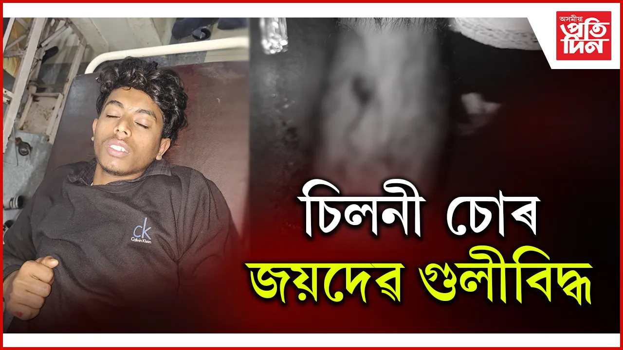 ৬০ টাকৈ চিলনী চোৰ কৰা জয়দেৱৰ ভৰিত লাগিল গুলী...