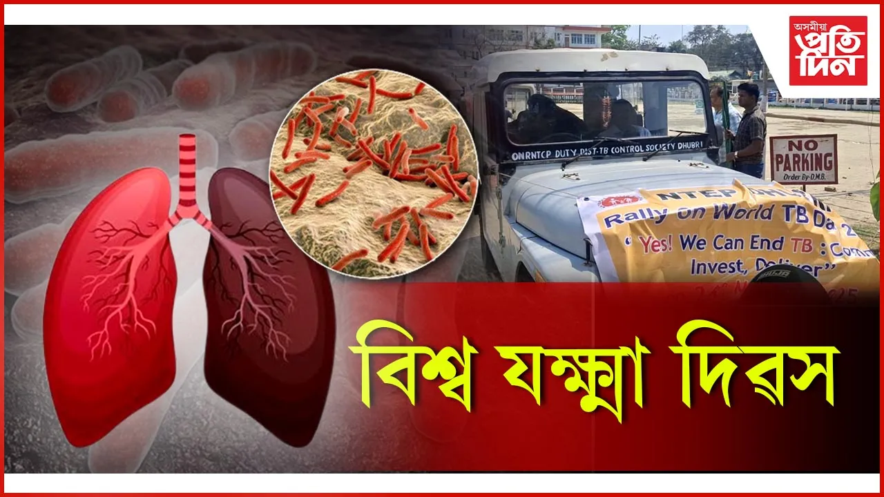 বিশ্ব যক্ষ্মা দিৱস