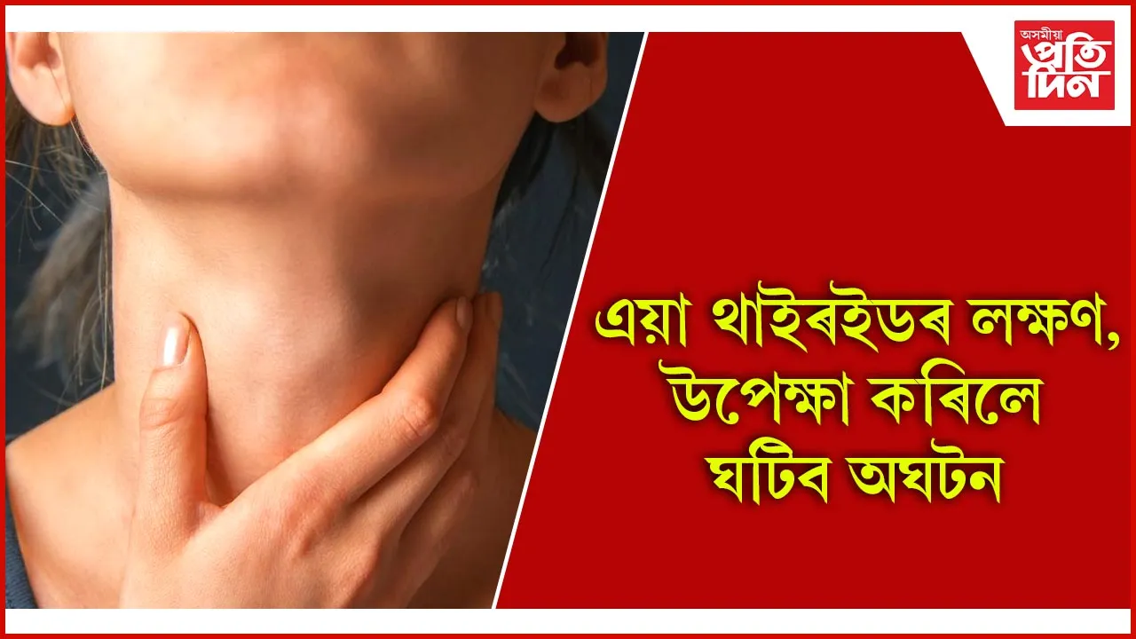 থাইৰইড