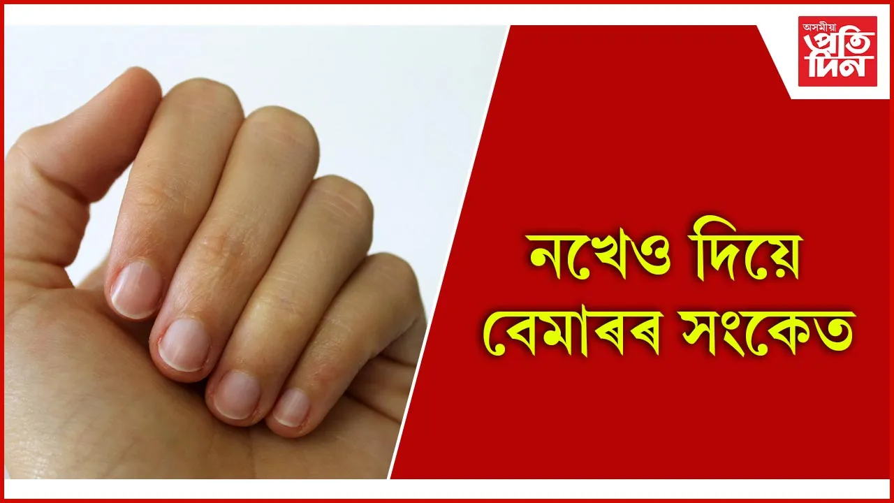 নখ 