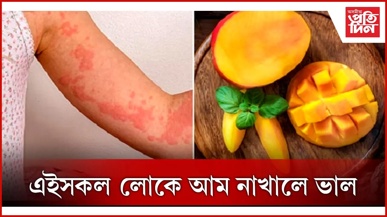 আম 