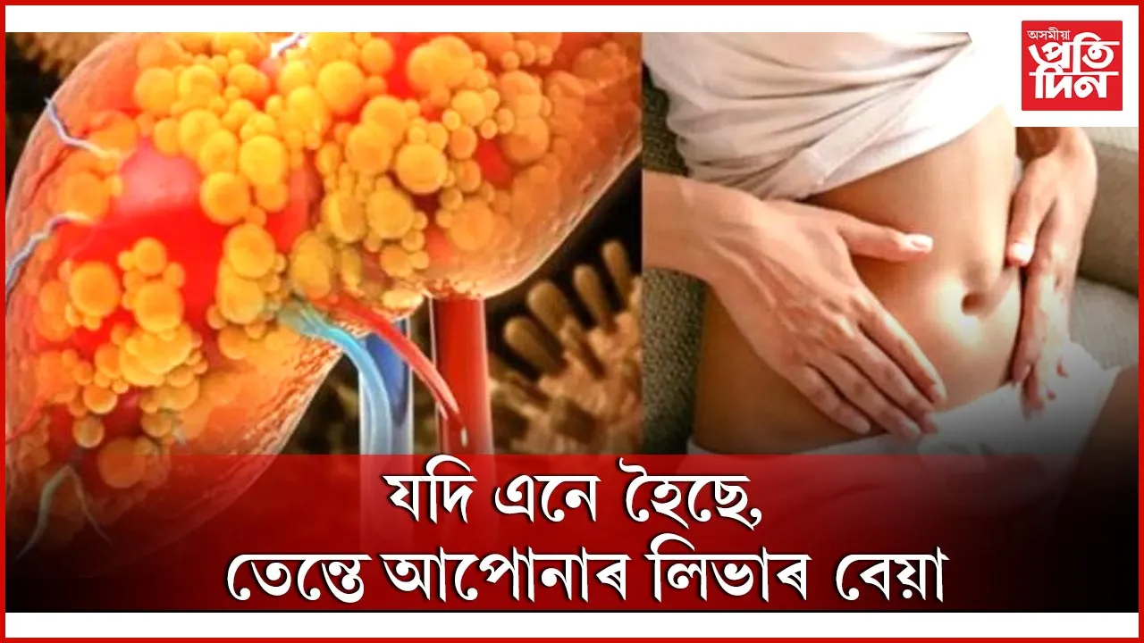 লিভাৰ বেয়া