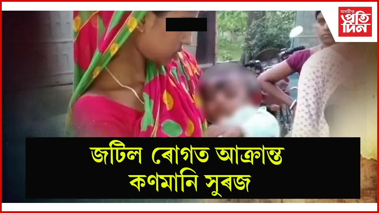 জটিল ৰোগত আক্ৰান্ত কণমানি সুৰজ