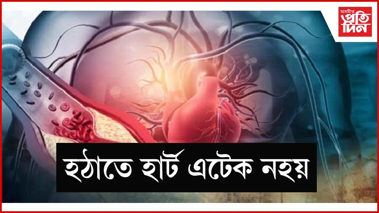 seo web   হাৰ্ট এটেক