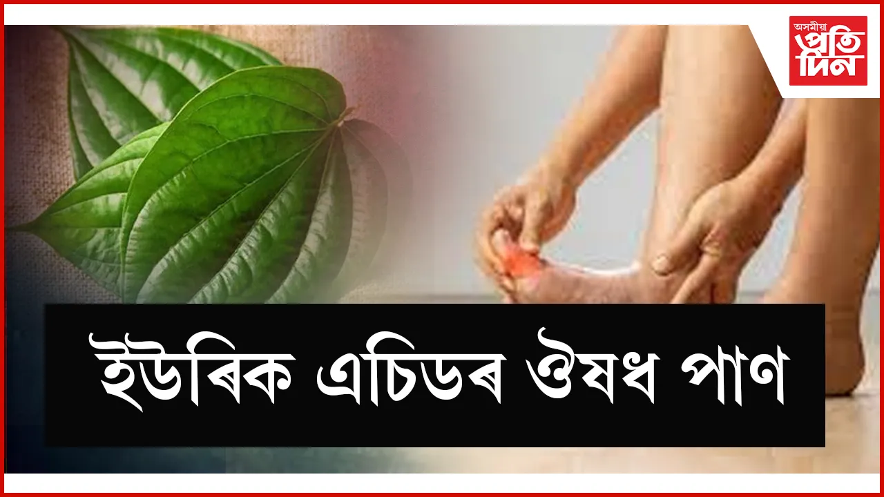 seo  ইউৰিক এচিড