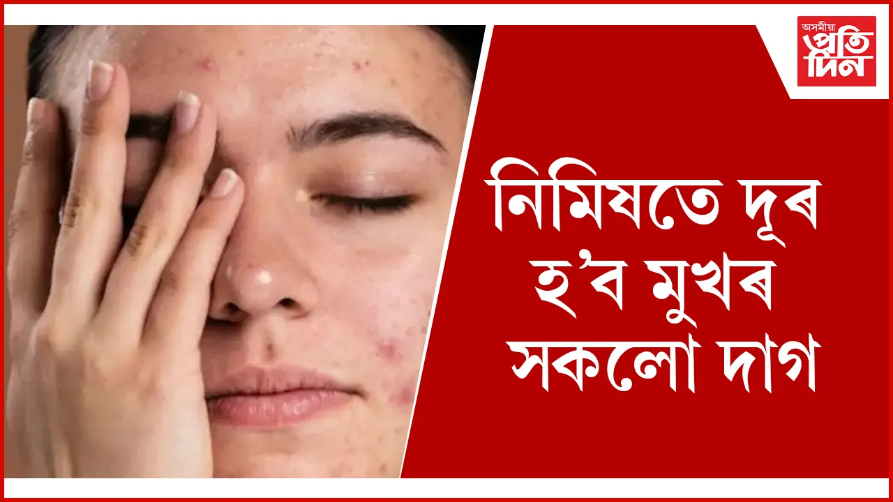 মুখৰ  দাগ seo