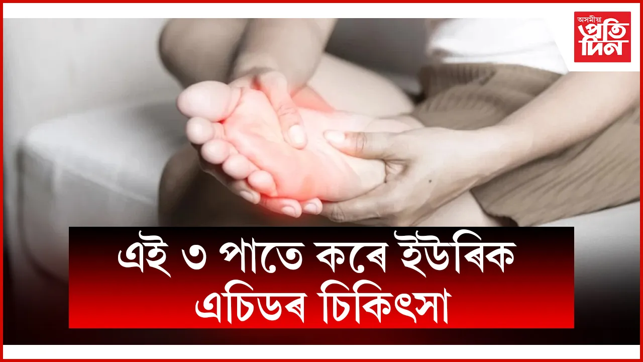 web ap uric acid