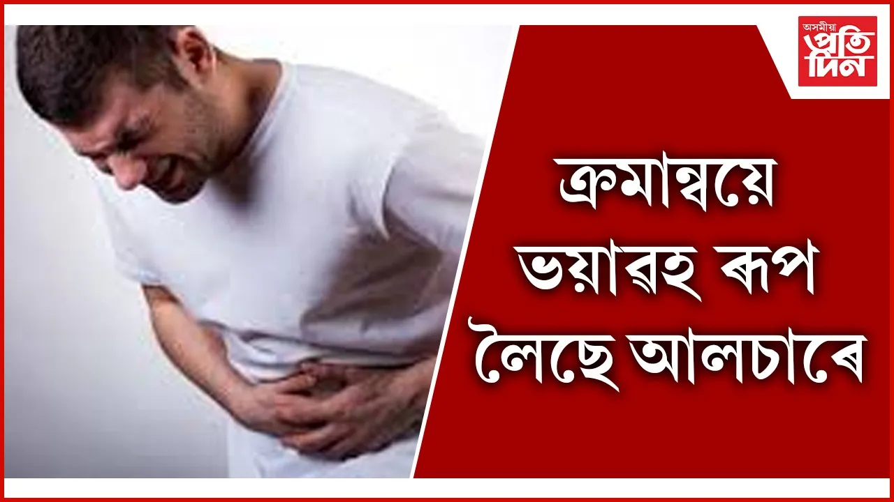 আলচা seo