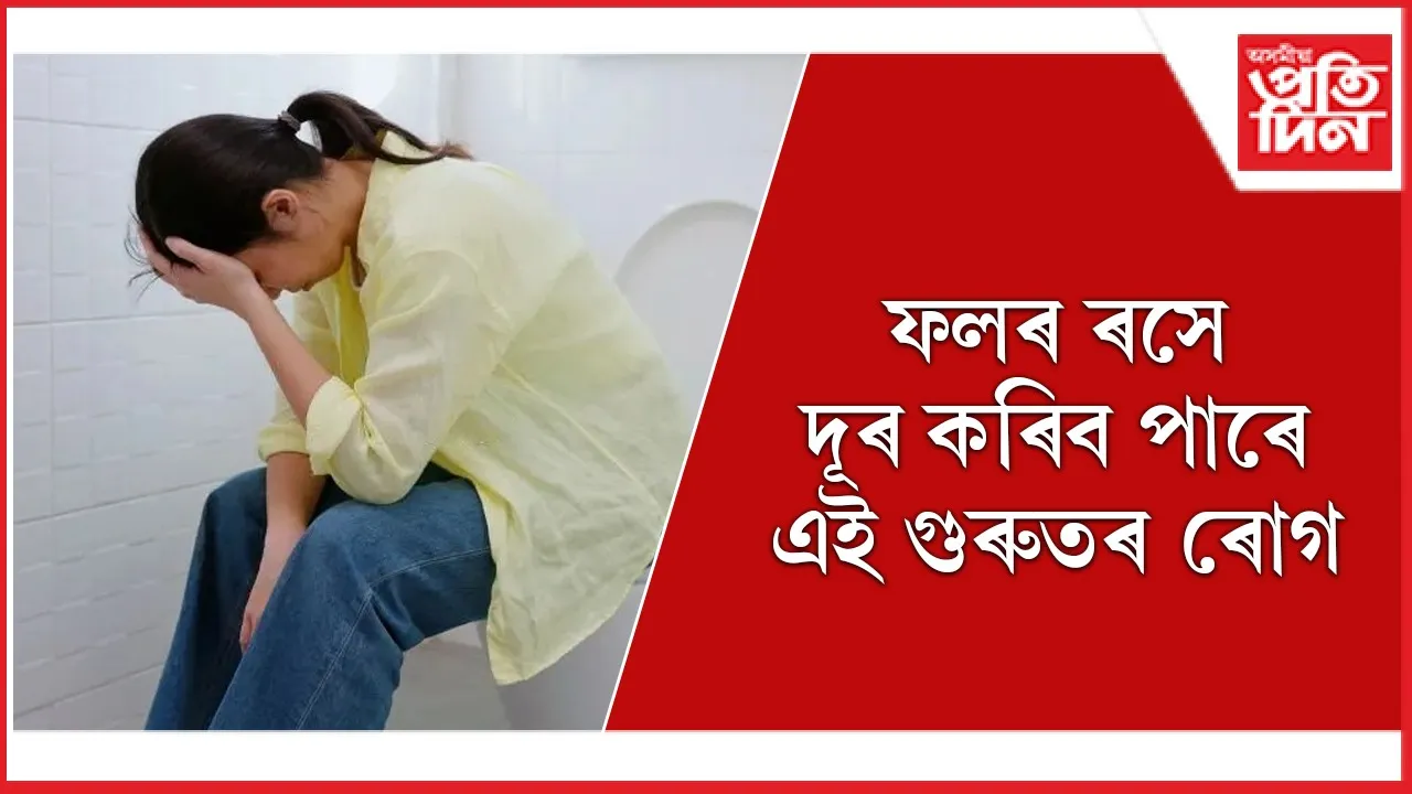 ৰোগ web