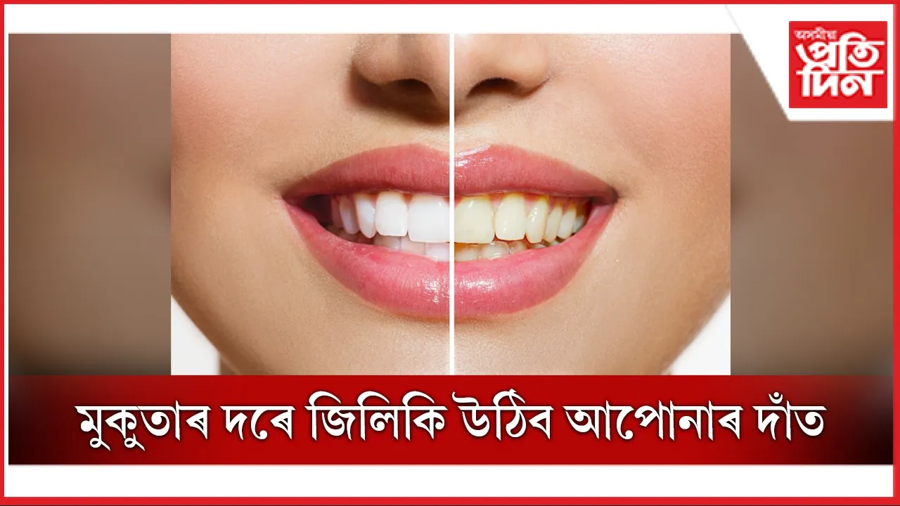 দাঁত