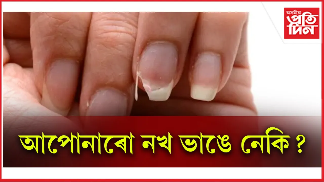 নখ web