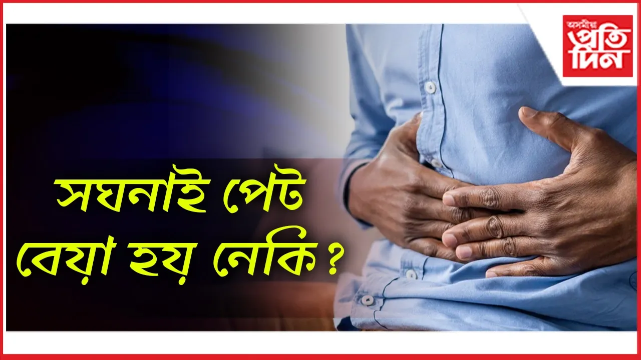 সঘনাই পেট বেয়া