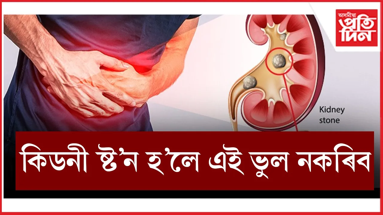 কিডনী fht.jpg