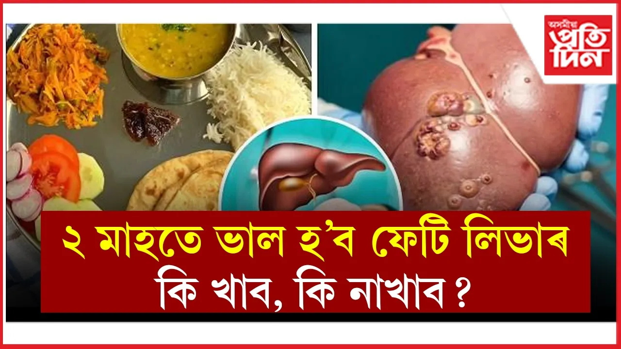 ফেটি লিভাৰ nfvgngf.jpg