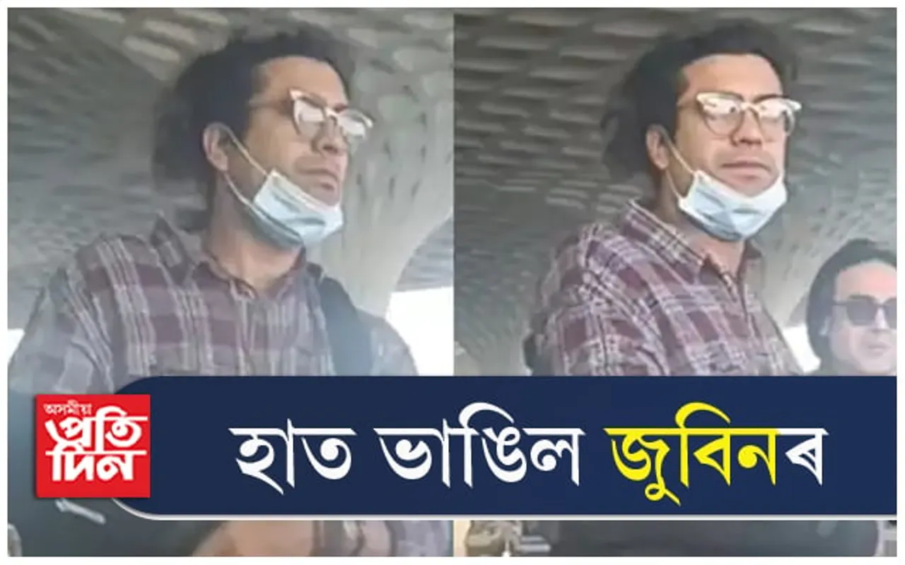 দুৰ্ঘটনাত হাত ভাঙিল জুবিনৰ... 