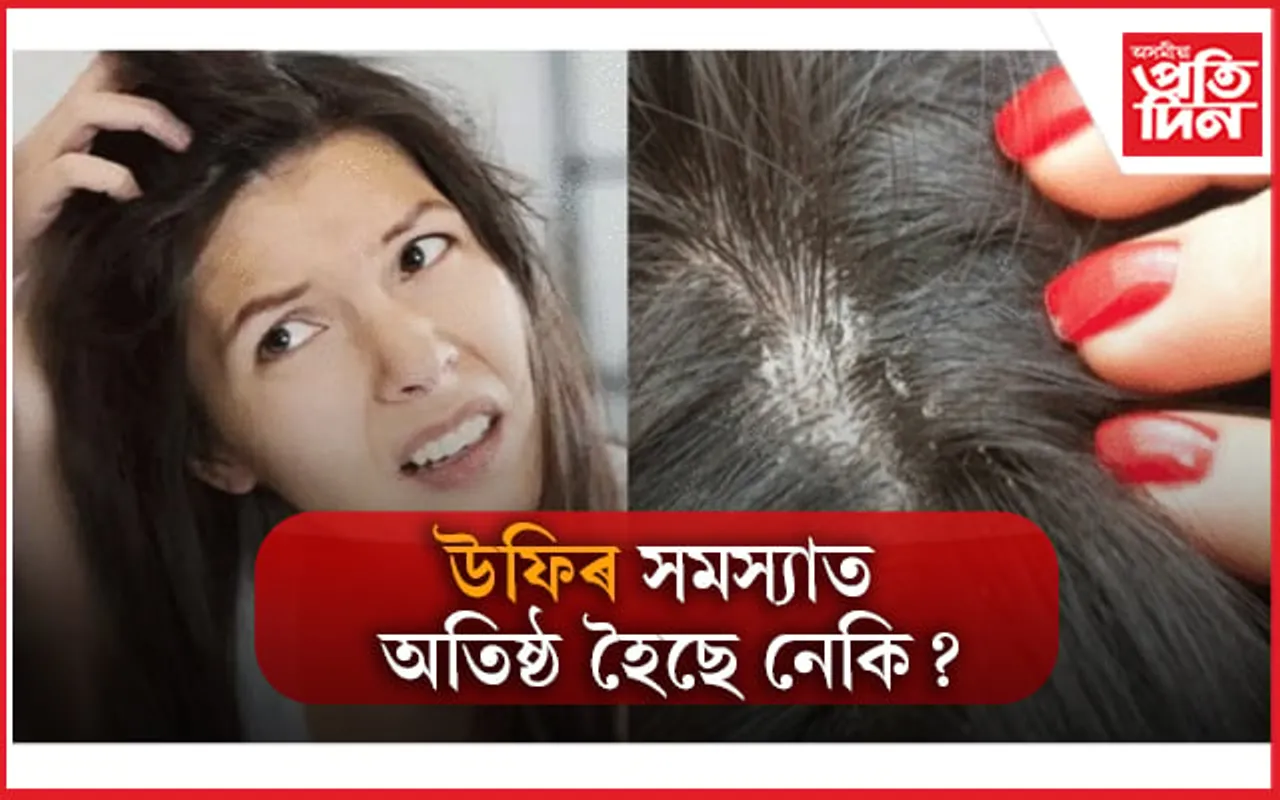 এই ঘৰুৱা উপায়ৰে উফিৰ পৰা পৰিত্ৰাণ পাওঁক