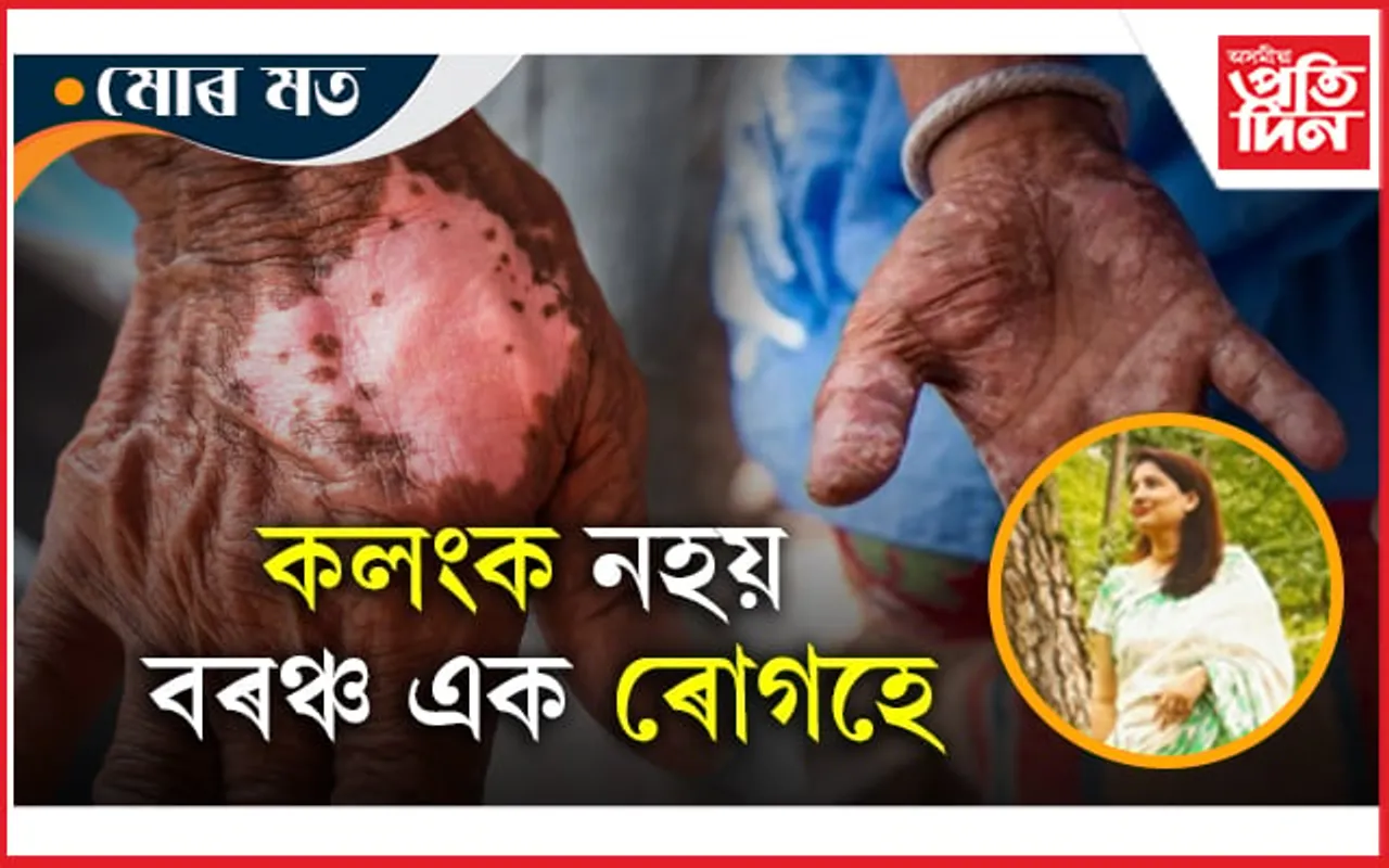 চৰ্ম আৰু ইয়াৰ সৈতে জড়িত ৰোগসমূহ...
