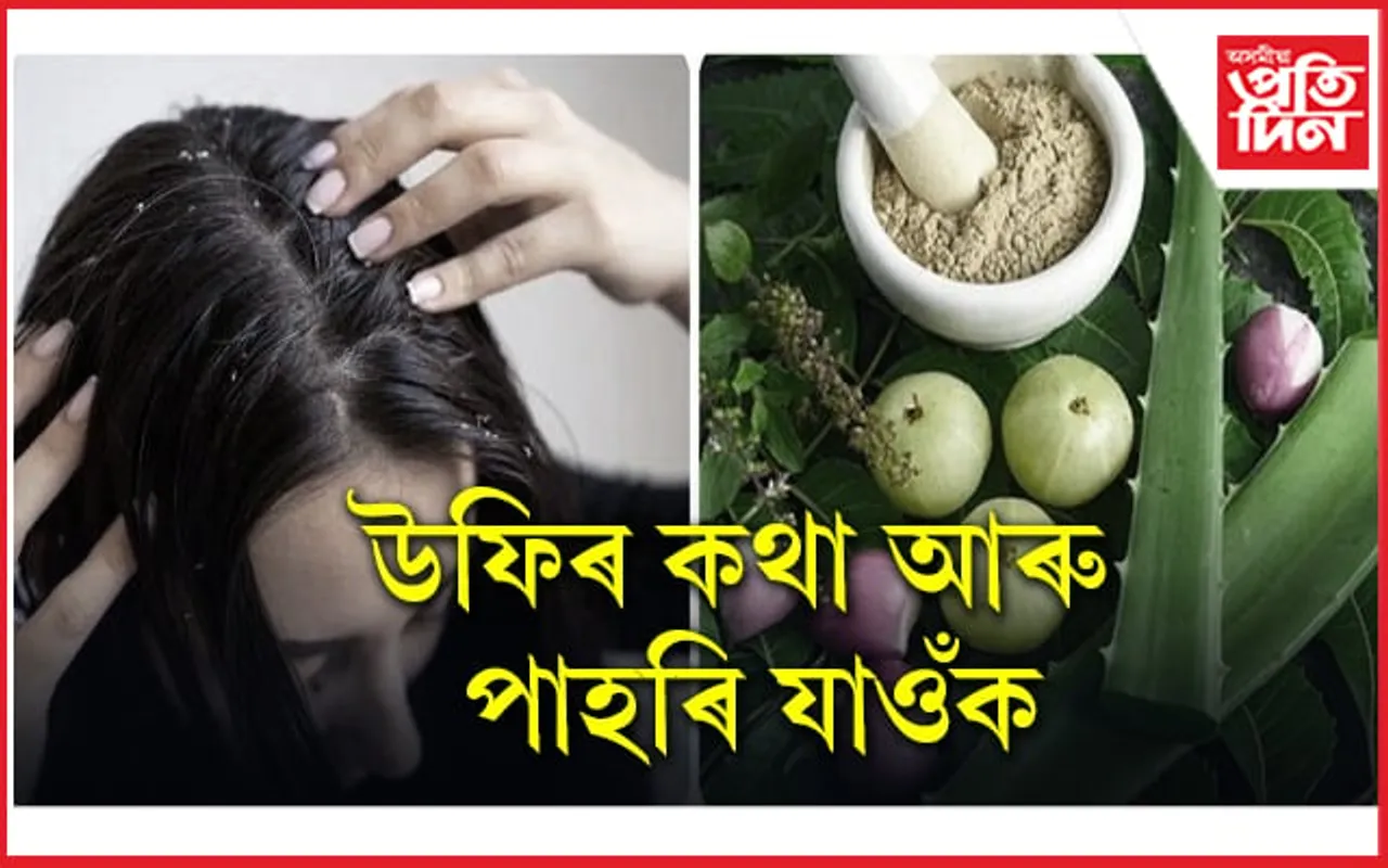 দামী দামী ছেম্পুৰ সলনি ঘৰতে কৰিব পাৰি উফিৰ সমাধান