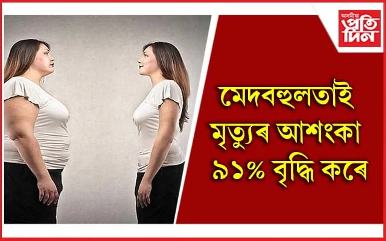 এইদৰে কৰক মেদবহুলতা নিয়ন্ত্ৰণ 