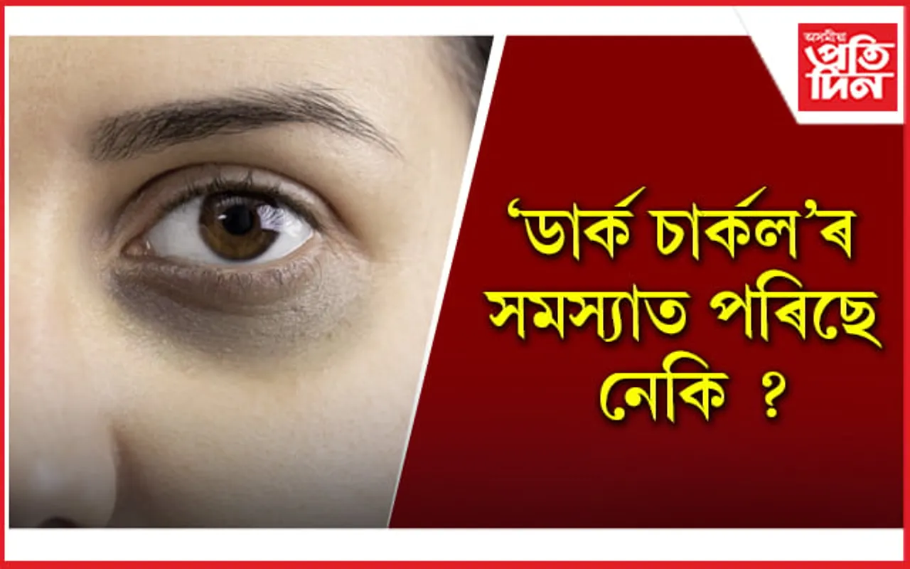 ঘৰুৱা প্ৰতিকাৰৰে এই সমস্যাৰ সমাধান পাওঁক