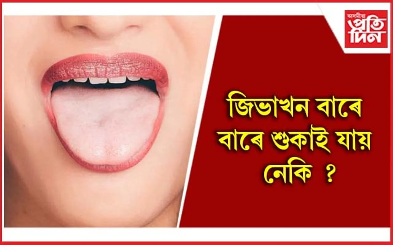 এয়া বেমাৰৰ লক্ষণ, অৱহেলা নকৰিব