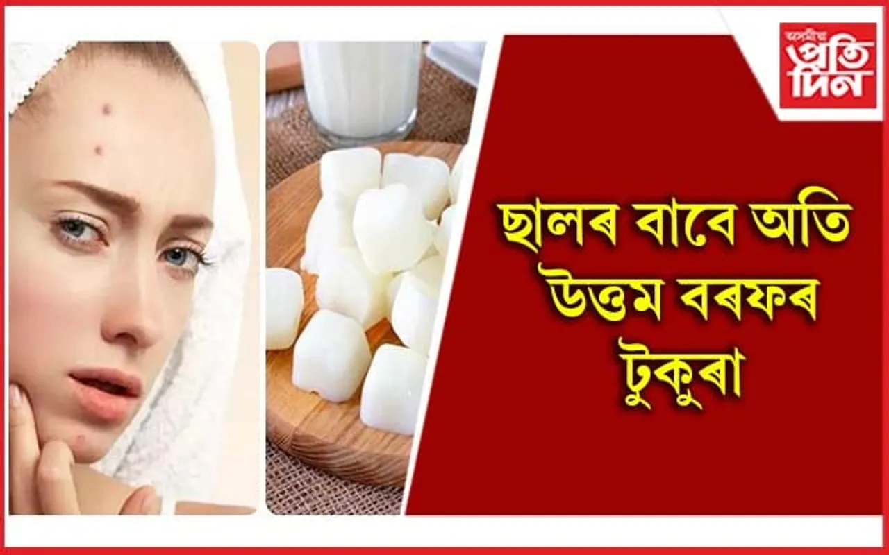 ছালৰ বহু সমস্যাৰ সমাধান দিয়ে বৰফৰ টুকুৰাই