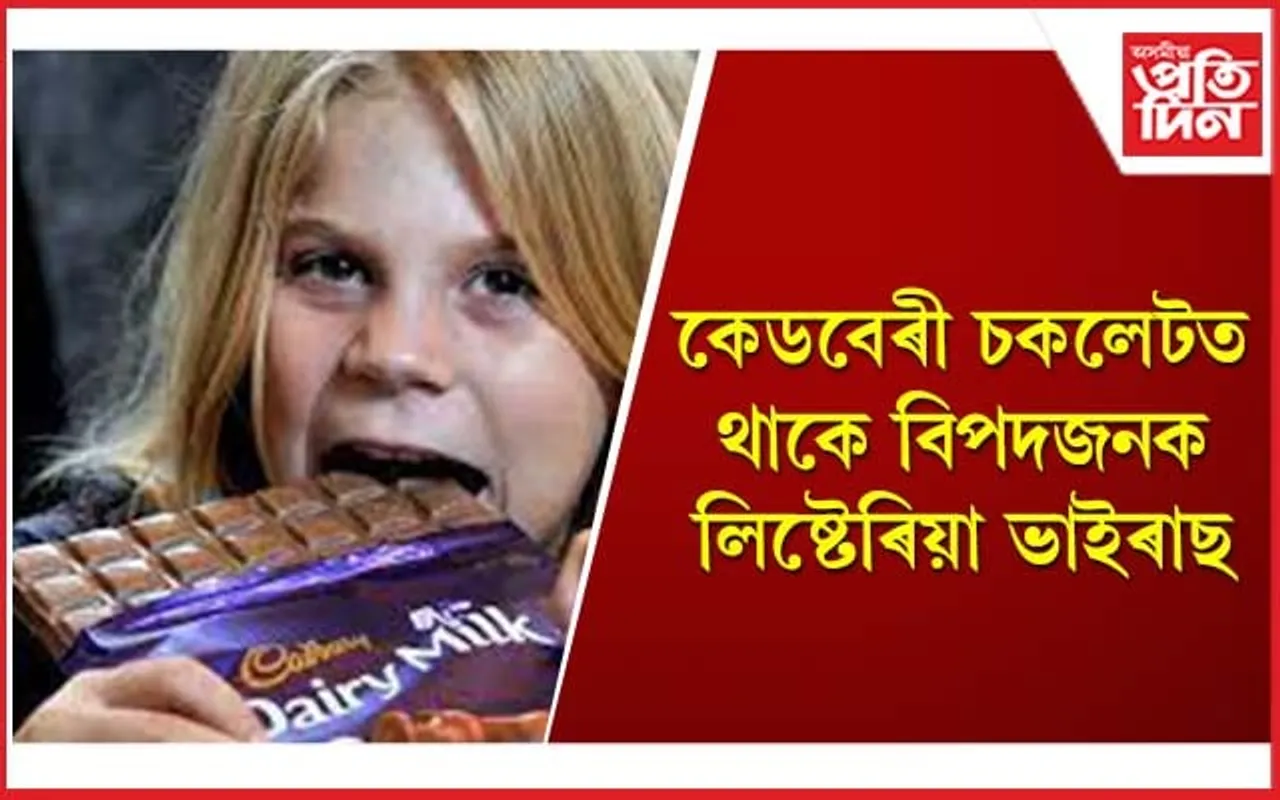 সাৱধান! চকলেট খোৱাৰ অভ্যাসে মাতিব পাৰে ভয়াৱহ বিপদ