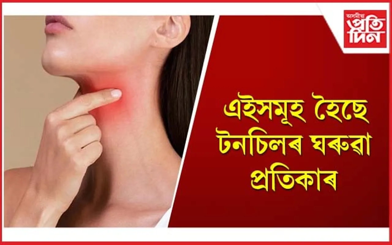 টনচিল সোনকালে ভাল নোহোৱাটো গুৰুতৰ ৰোগৰ লক্ষণ