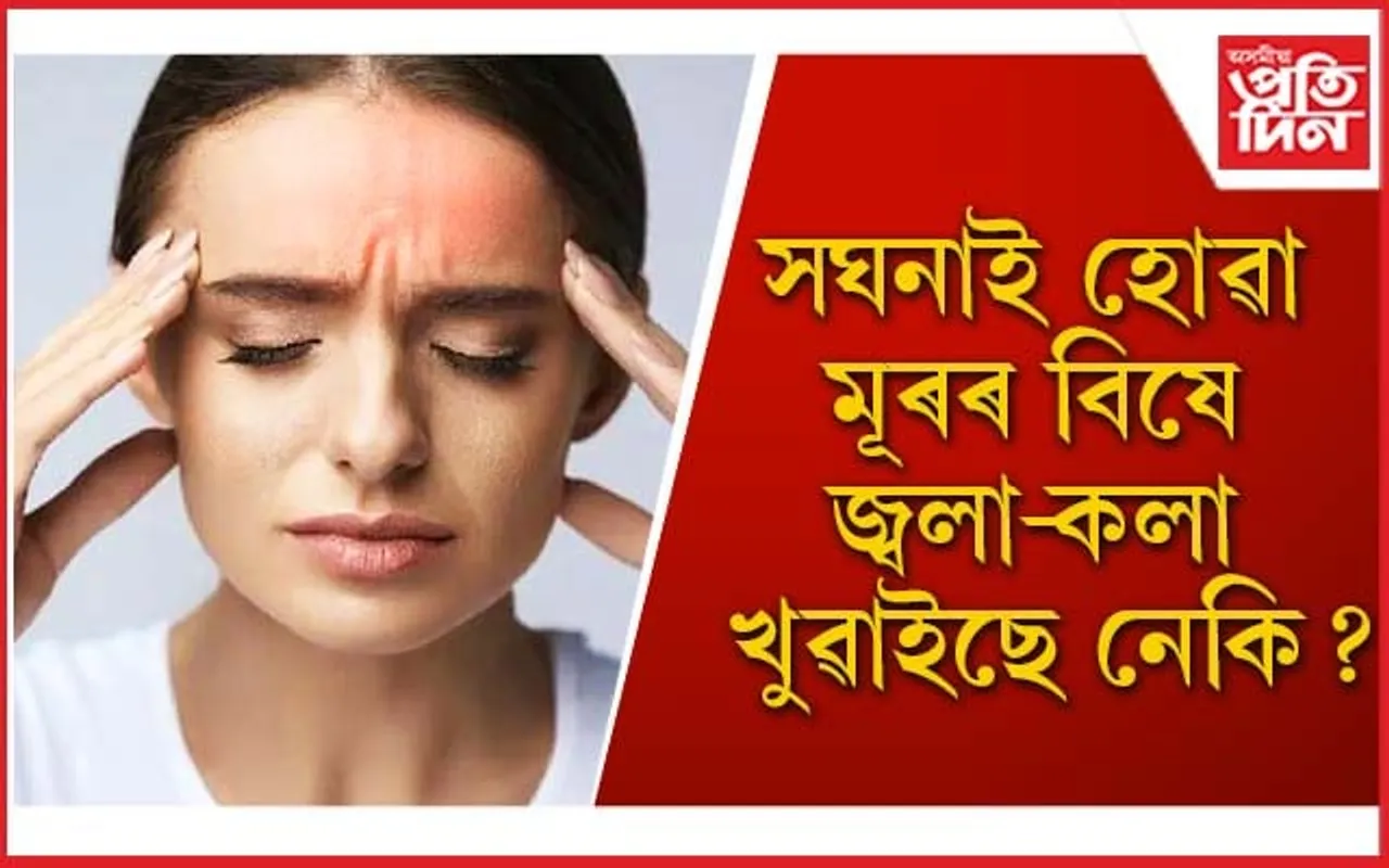 এইদৰে নিমিষতে দূৰ কৰক অসহ্য মূৰৰ বিষ