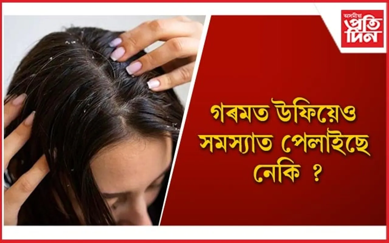এইসমূহ ঘৰুৱা প্ৰতিকাৰৰে স্বাস্থ্যকৰ কৰি ৰাখক আপোনাৰ চুলি