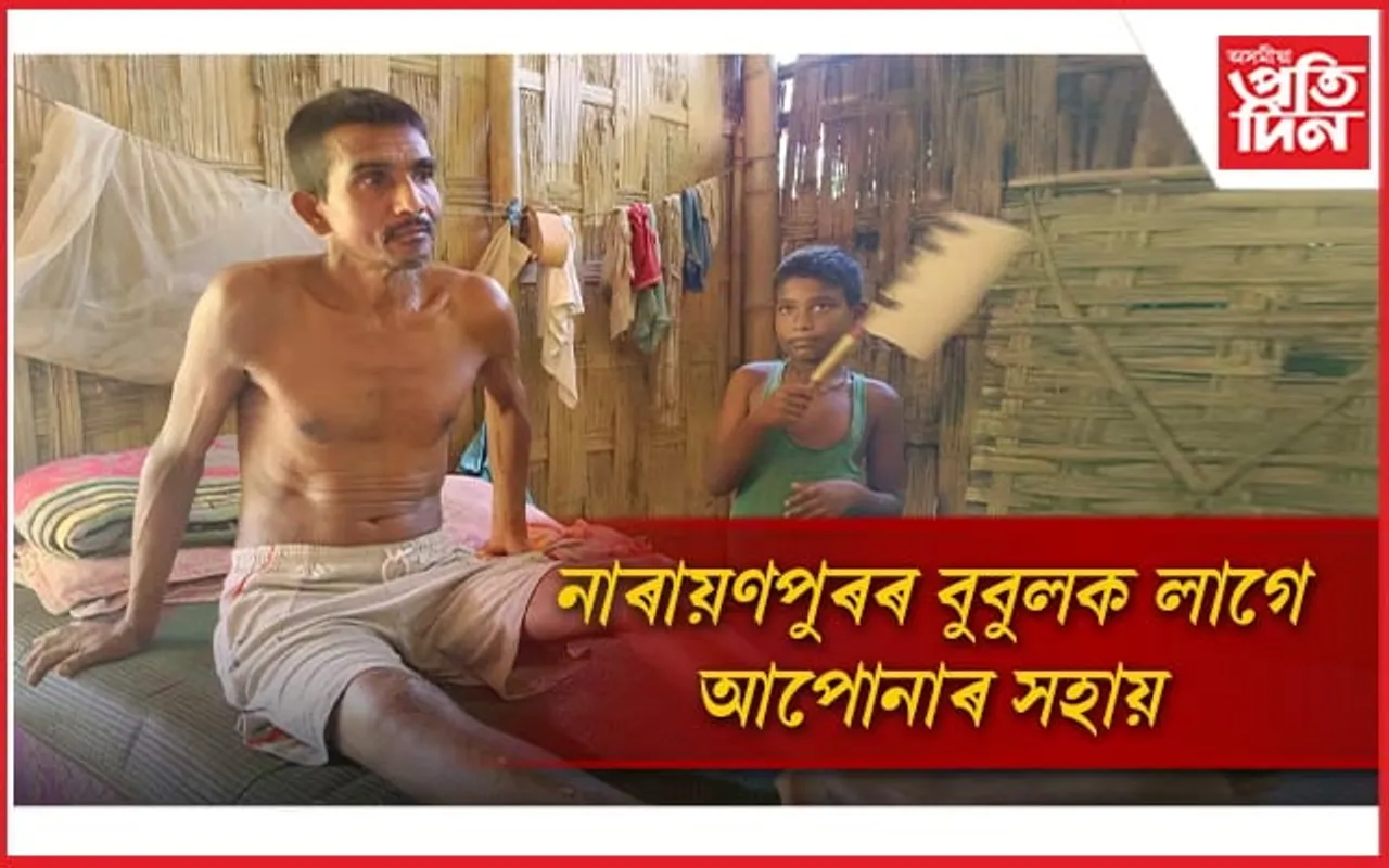 দুৰ্ঘটনাৰ বলি হৈ চাৰি মাহে পৰি আছে বিচনাতঃ নাই ৰেচন কাৰ্ড, আয়ুস্মান কাৰ্ড...