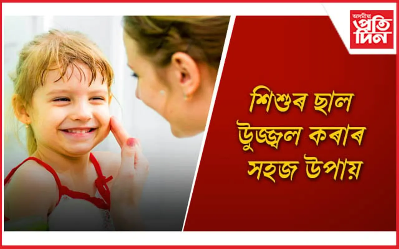 শিশুৰ কোমল ছালখনৰ আপুনি কিদৰে যত্ন লয় ?  