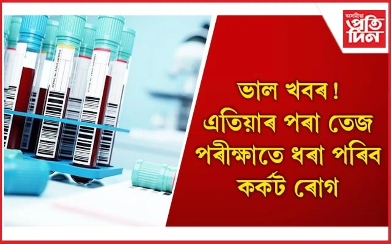 একেলগে চিনাক্ত হ’ব ৫০ প্ৰকাৰৰ কৰ্কট ৰোগ, নতুন পৰীক্ষাই আনিছে আশাৰ বতৰা
