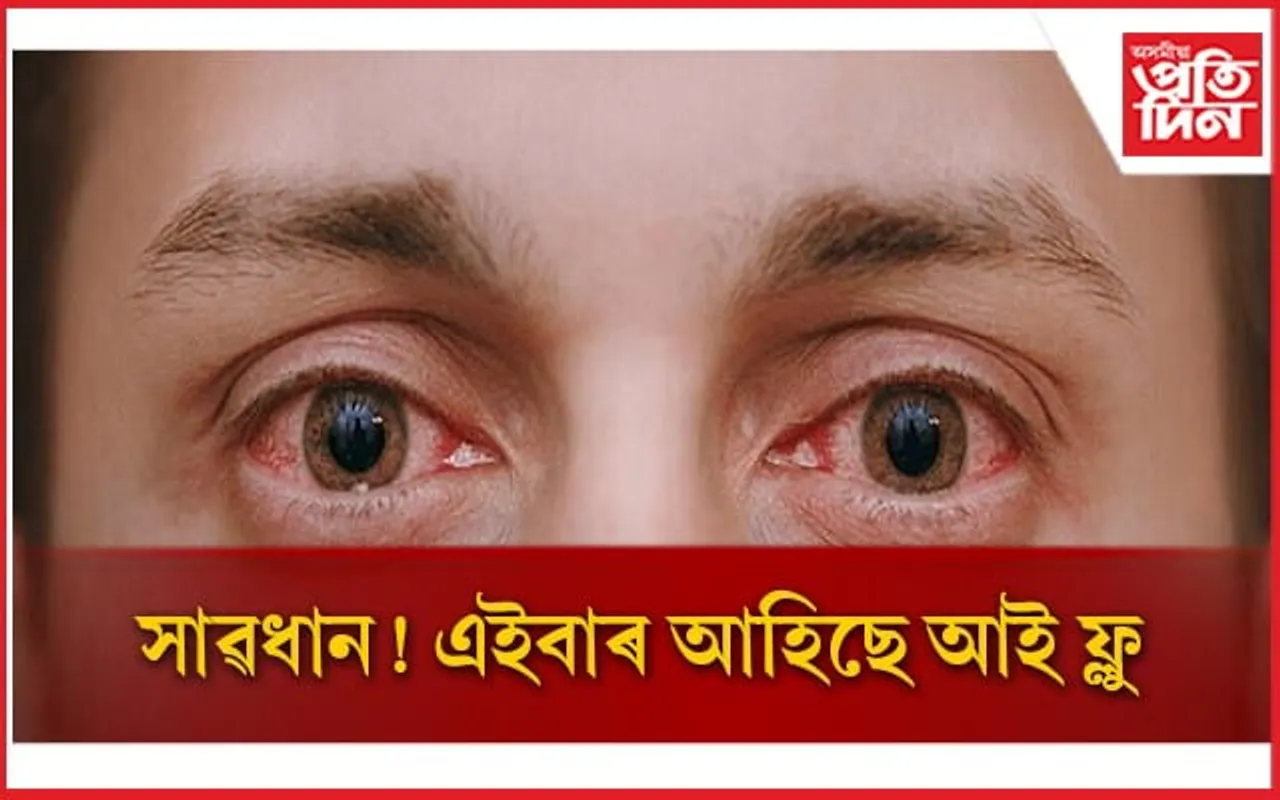 লক্ষণ জানি লৈ সৰ্তকতা অৱলম্বন কৰক, অন্যথা হেৰুৱাব দৃষ্টিশক্তি