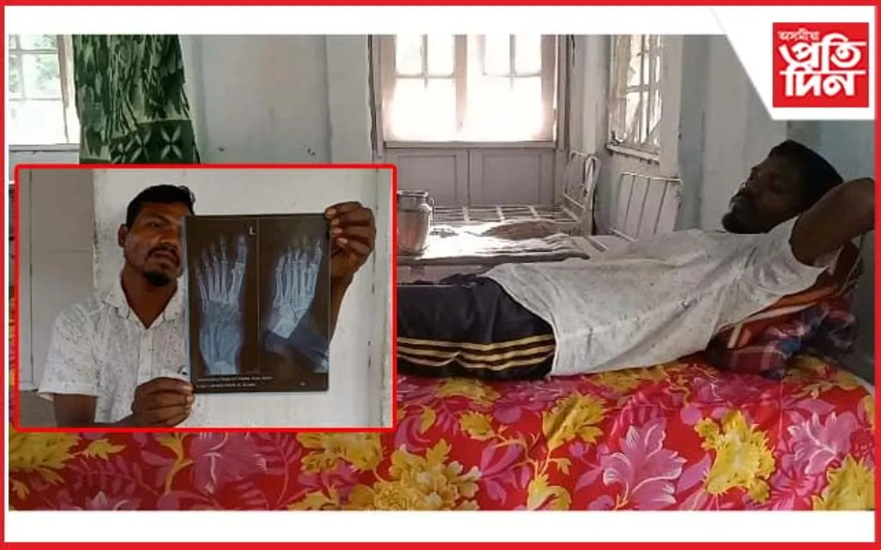 বোকাখাতত চিকিৎসাৰ বিসংগতি ! ভৰি ভঙাৰ পিছতো সুস্থ বুলি জনালে চিকিৎসকে...