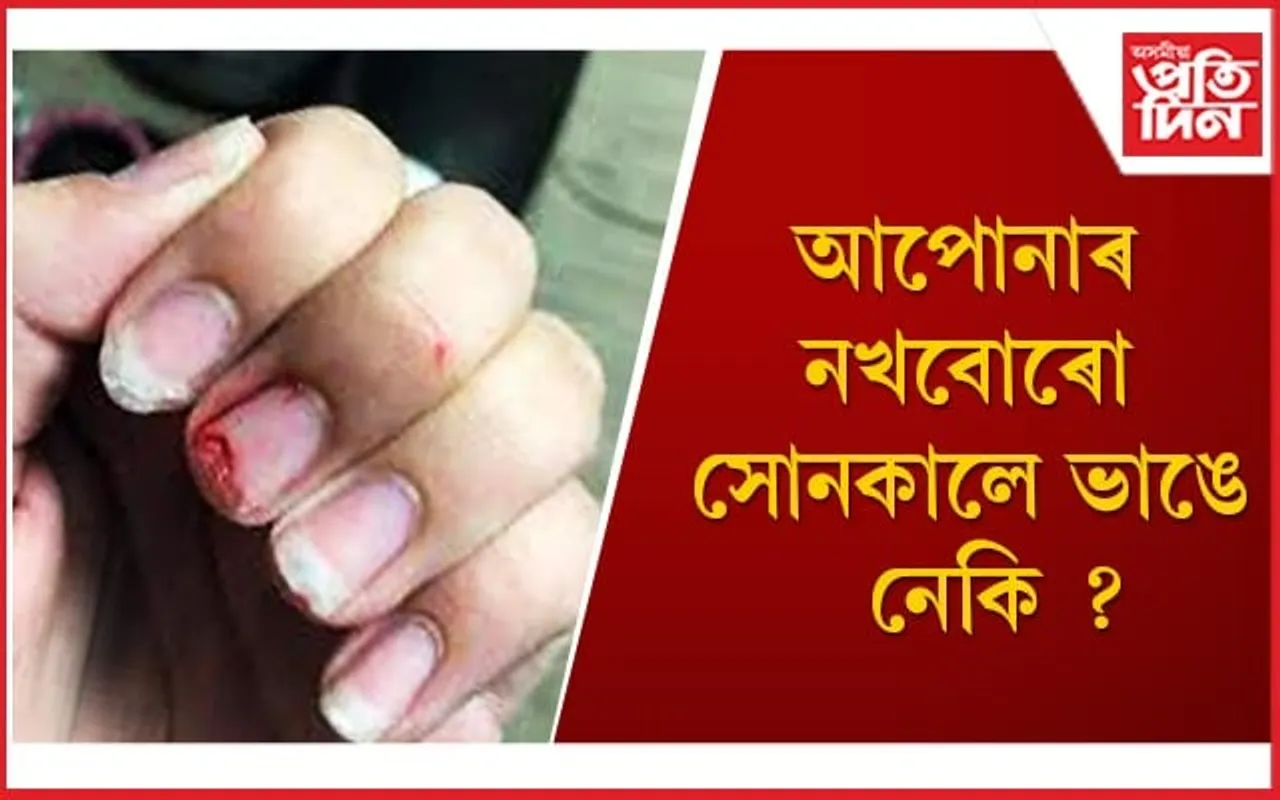নখ ধুনীয়া কৰি ৰখাৰ ৫ টা ঘৰুৱা উপায়