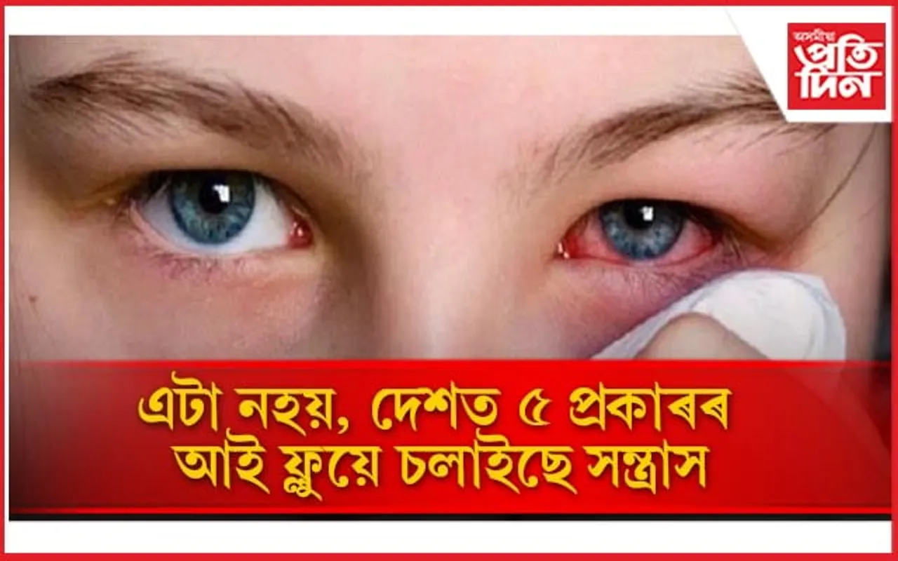 সকলো প্ৰকাৰৰ আই ফ্লুৰ লক্ষণ জানি লৈ সৰ্তক হওঁক 