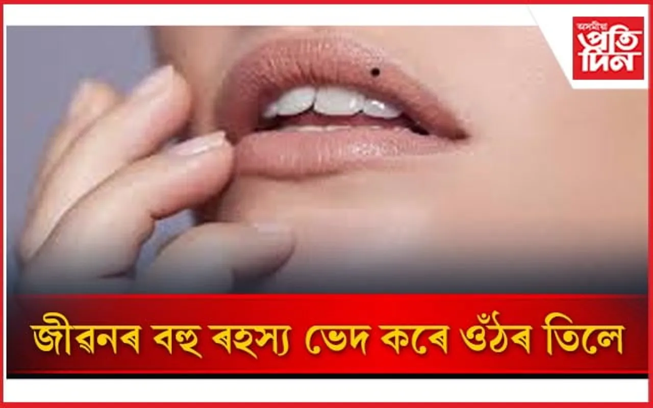 ওঁঠৰ বিভিন্ন অংশত থকা তিলে কি সূচায়, জানি লওঁক