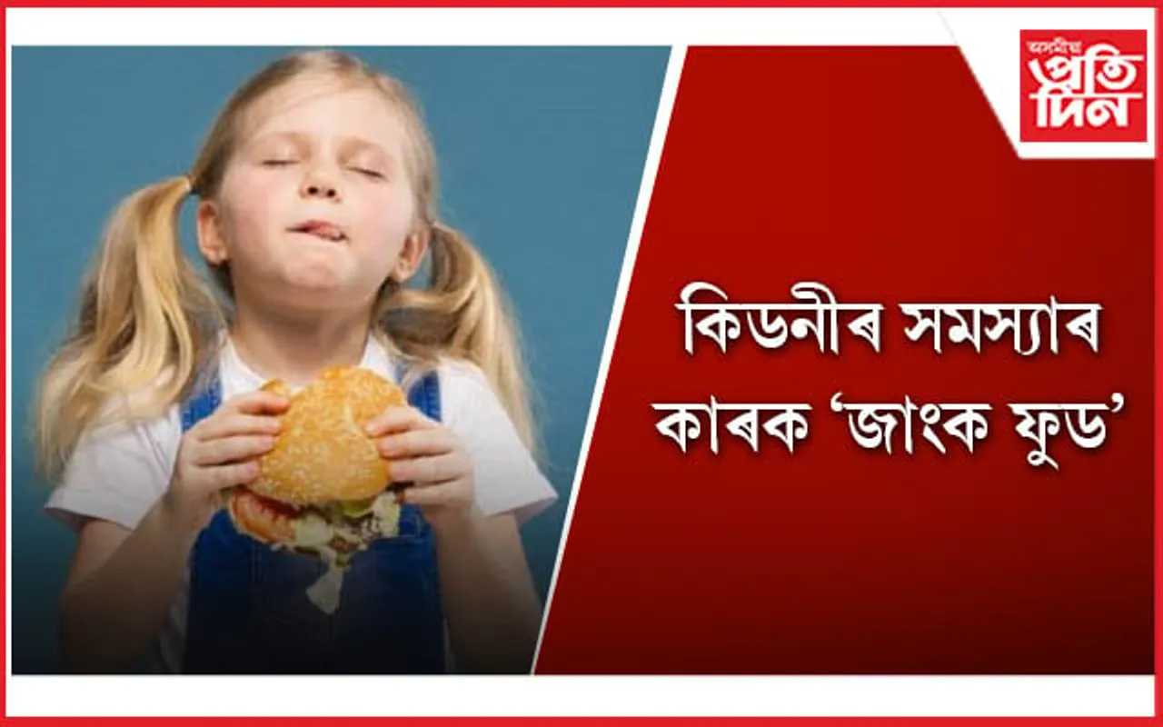 সন্তানক খাবলৈ দিওঁতে অভিভাৱকসকল সাৱধান হওঁক