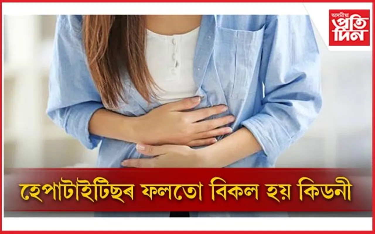 হেপাটাইটিছত আক্ৰান্তসকলে কি খাদ্য খাব, কি পৰিহাৰ কৰিব জানি লওঁক