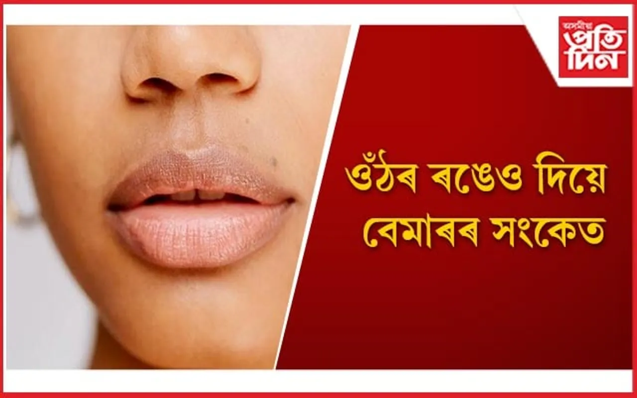 সতৰ্ক হ'ব, ওঁঠৰ ৰং সলনি হোৱাটো এই ৪ ৰোগৰ লক্ষণ